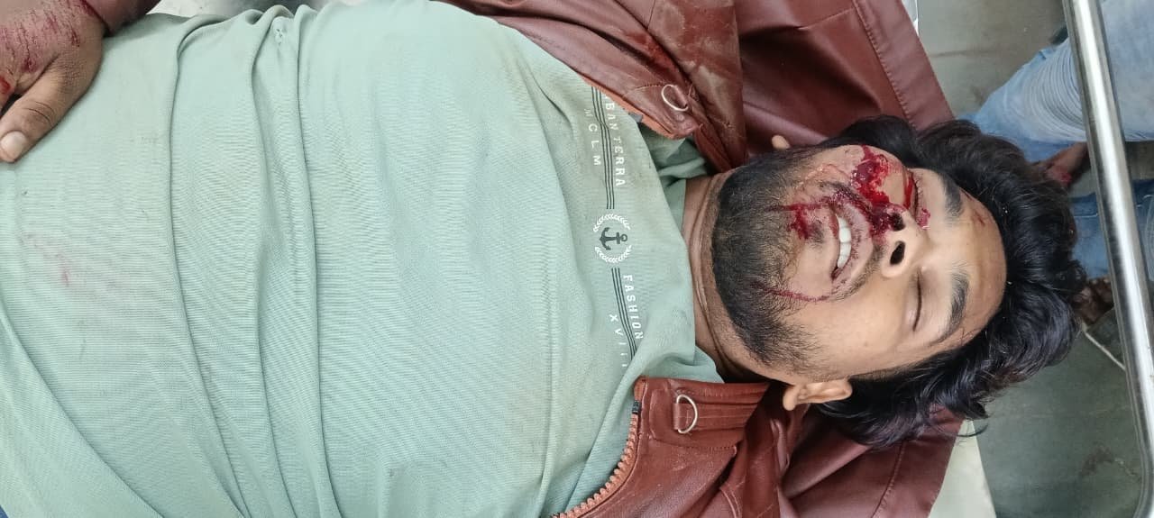 अकलतरा में ट्रेलर ने बाइक सवार को रौंदा, युवक की हुई मौके पर दर्दनाक मौत, आक्रोषितों ने किया चक्काजाम