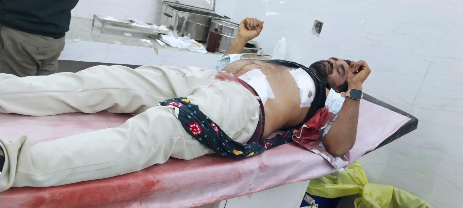 दो भाइयों पर चाकू से ताबड़तोड़ हमला