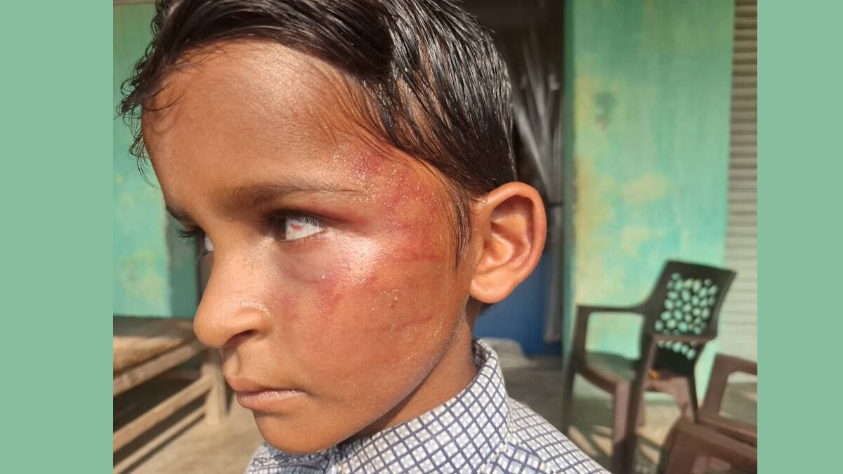 गिनती नहीं सुना पाने पर बच्चे पर थप्पड़ों की बारिश